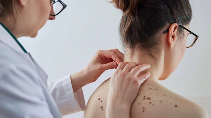 RNU5UZXPABACRHCB3V74JL7MSA