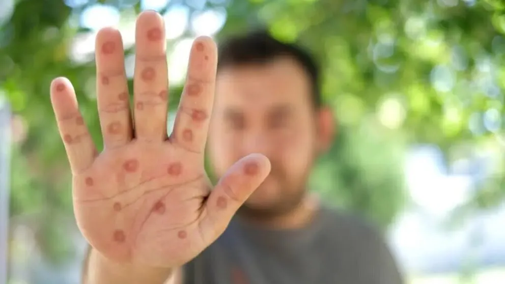 VDC5MQXOSVAHXLKMRO6CMPPYDI